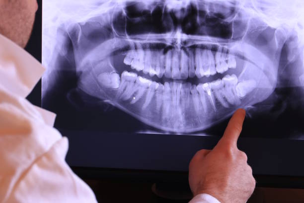 Best Tooth Infection Emergency Dentist  in Northdale, FL