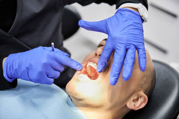 Best Knocked-Out Tooth Emergency  in Northdale, FL